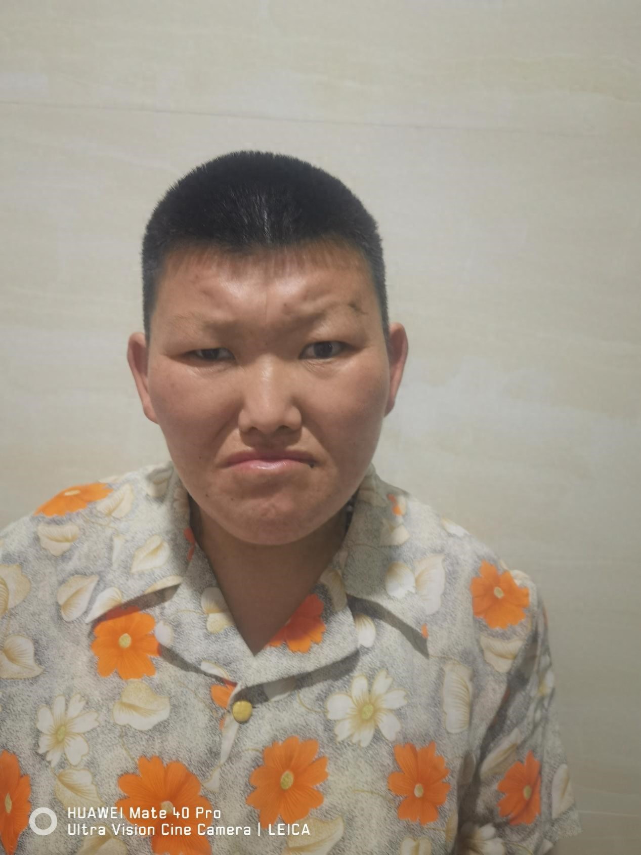 走失者照片 六安市寻亲：中年女子被救助，疑患智...