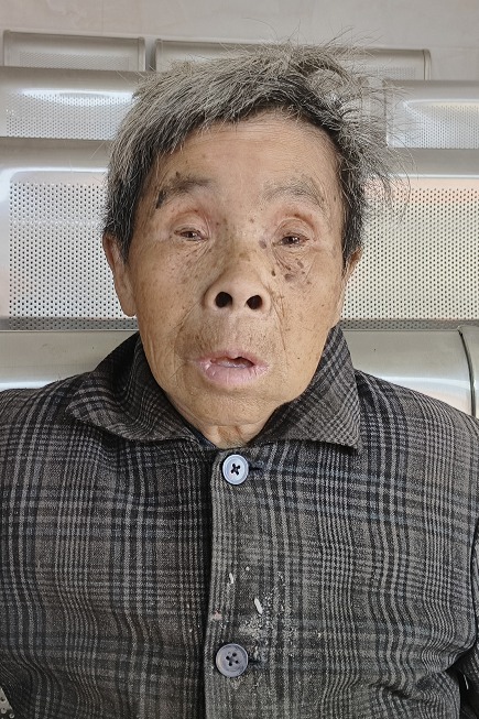 走失者照片 邵阳市寻亲：六旬老太被救助，穿黑灰...