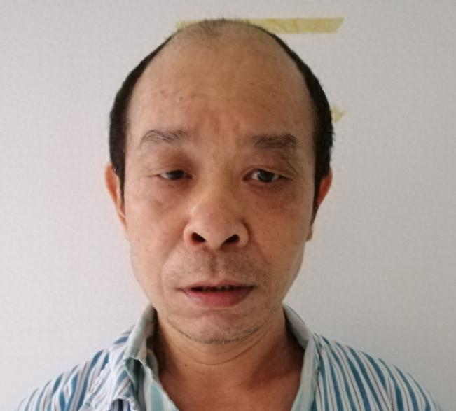 走失者照片 佛山市寻亲：五旬男子被救助，偏瘦，...