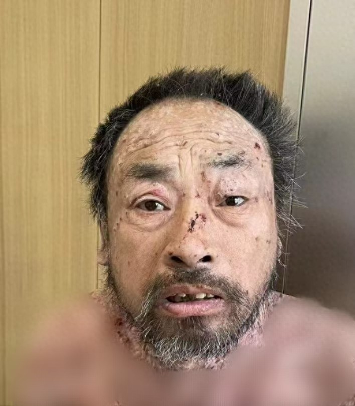 走失者照片 哈尔滨市寻亲：六旬老人被救助，言语...