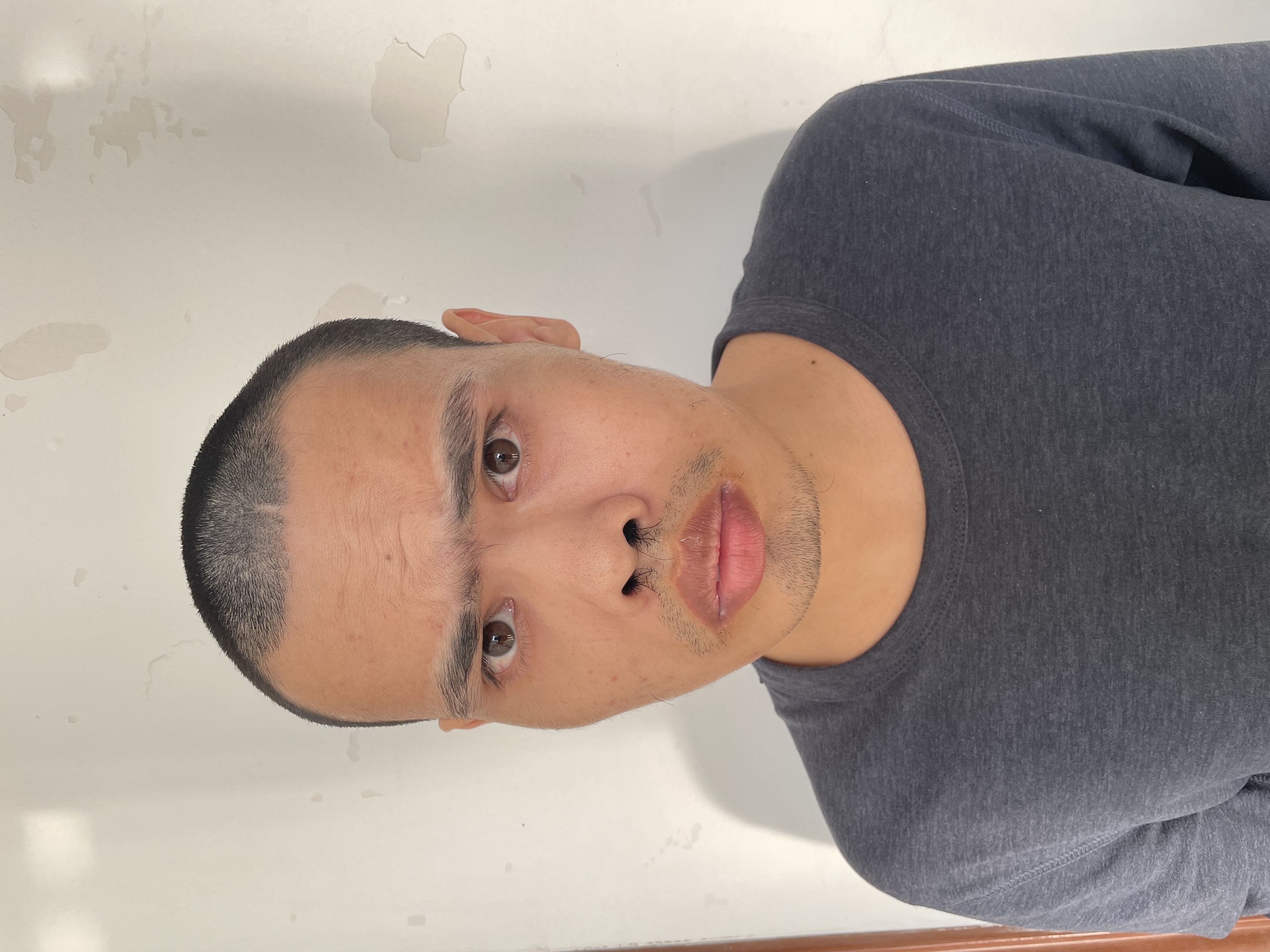 走失者照片 贵阳市寻亲：青年男子被救助，高1米...