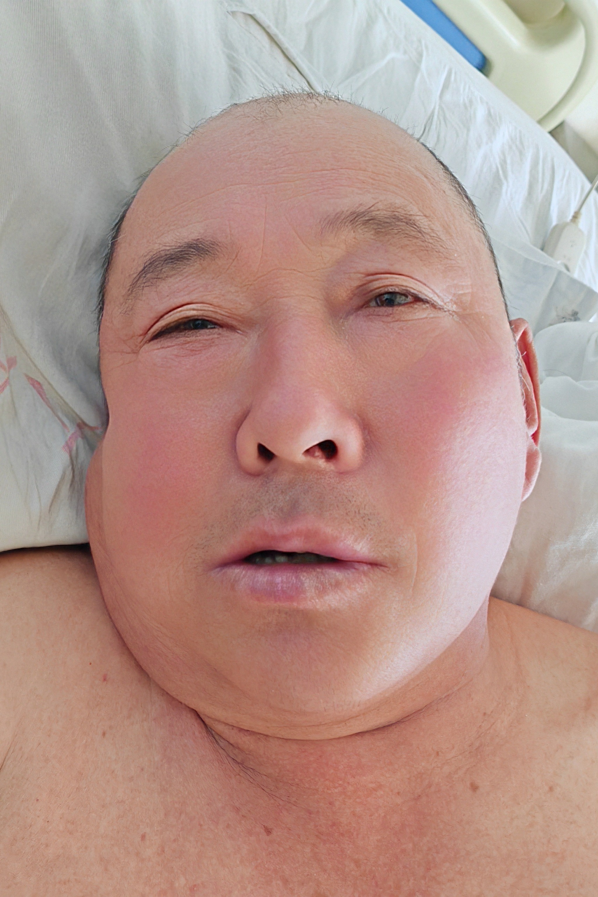 走失者照片 呼伦贝尔市寻亲：六旬老人被救助，高...