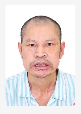 走失者照片 佛山市寻亲：中年男子被救助，高1米...