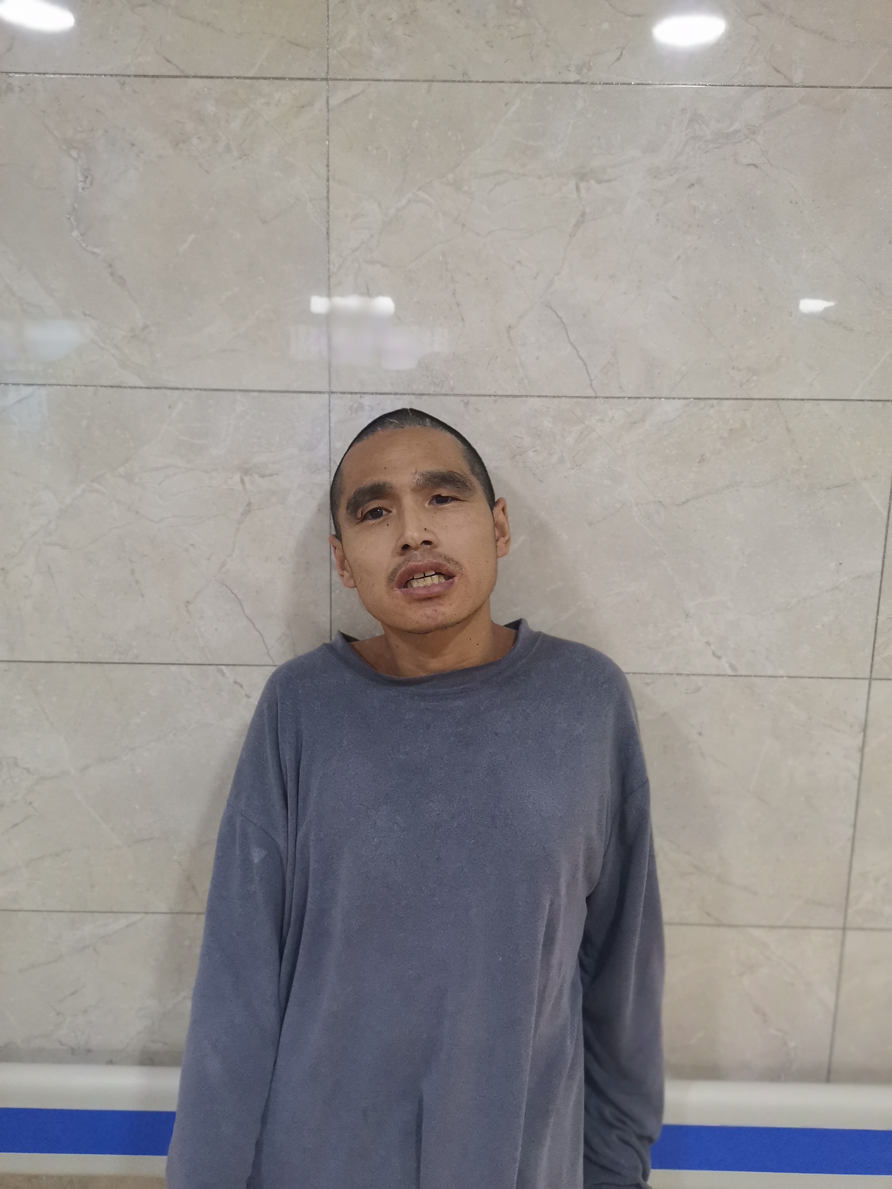 走失者照片 烟台市栖霞市寻亲：中年男子被救助，...