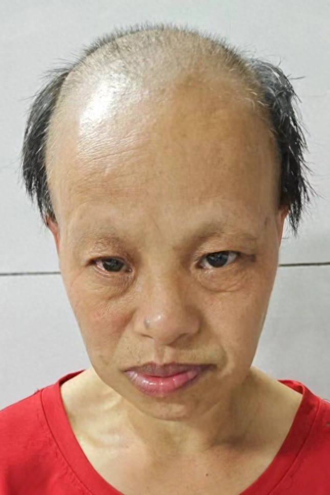 走失者照片 贵港市寻亲：中年女子被救助，高1米...