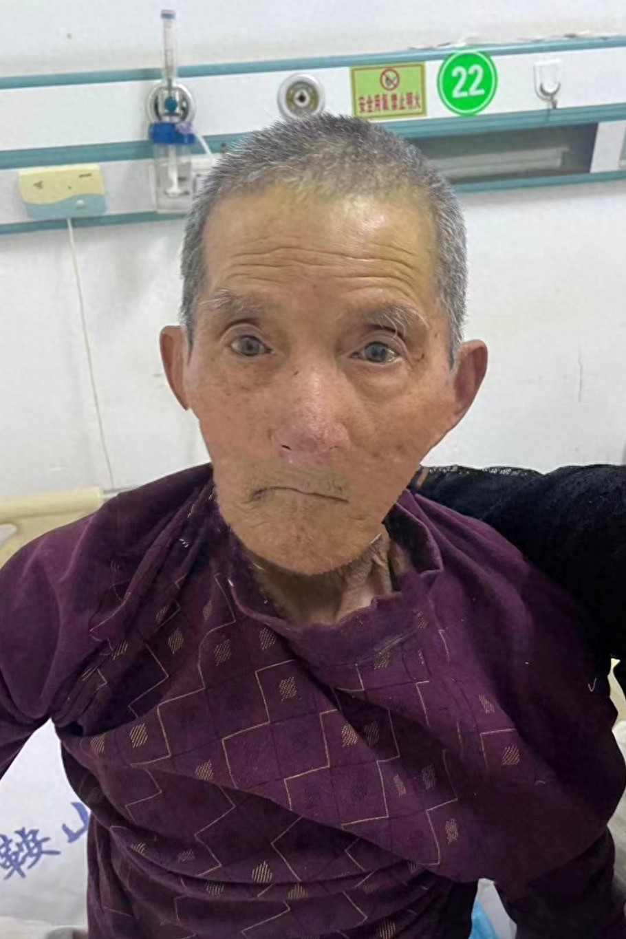 走失者照片 鞍山市寻亲：八旬老人被救助，高1米...