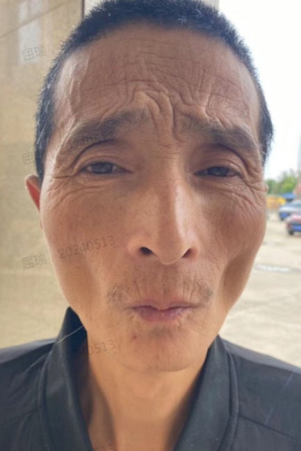 走失者照片 菏泽市寻亲：五旬男子被救助，自述叫...