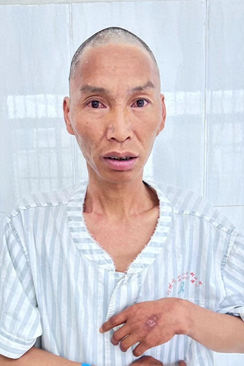 走失者照片 柳州市寻亲：青年男子被救助，穿黑色...