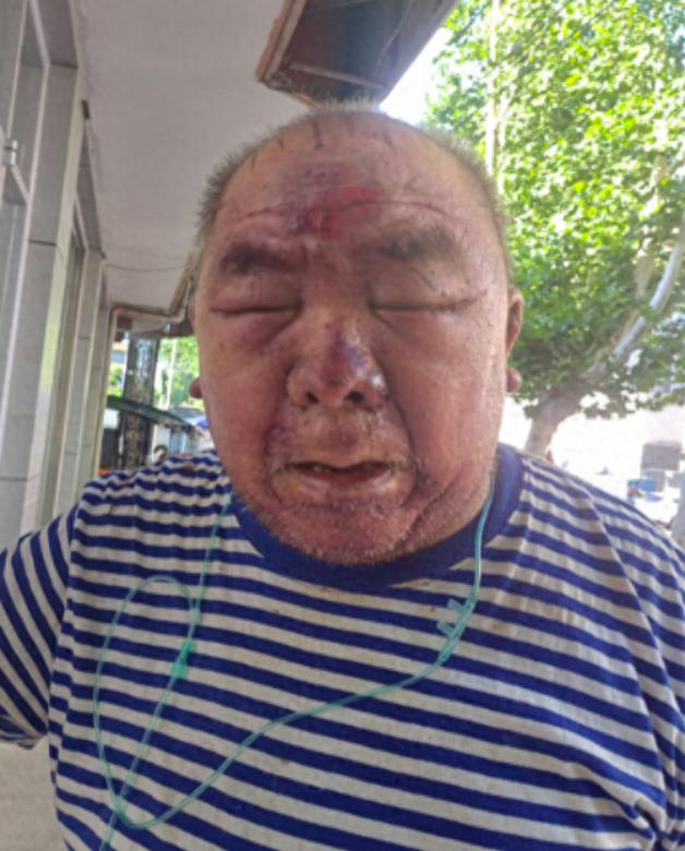 走失者照片 潍坊寻亲：六旬老人被救助，自述叫李...