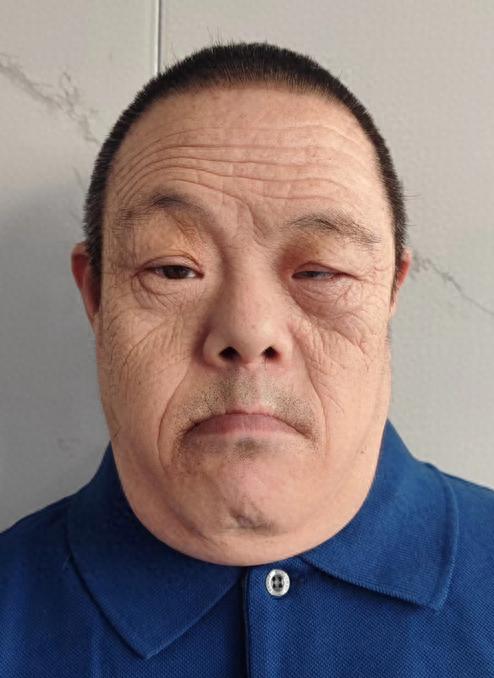 走失者照片 北京市寻亲：五旬男子被救助，高1米...