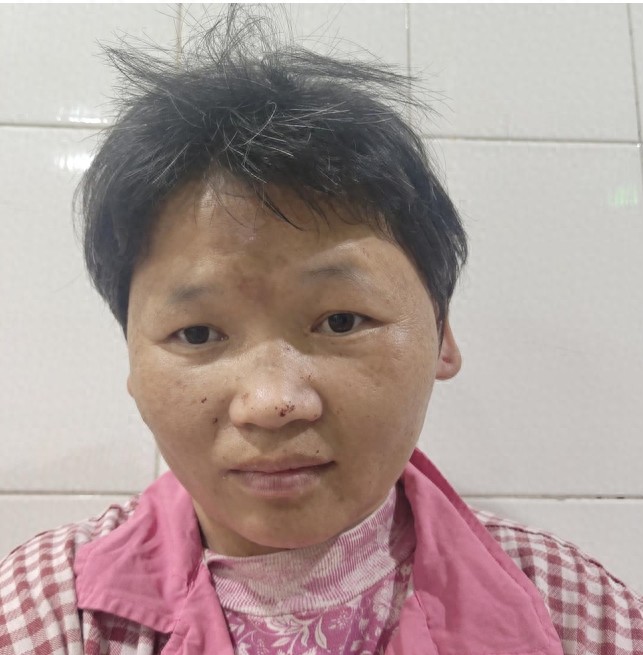 走失者照片 南京市寻亲：青年女子被救助，高1米...