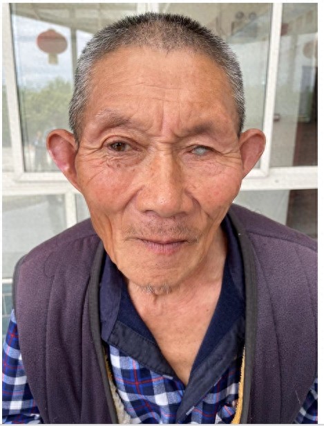 走失者照片 德阳市寻亲：七旬聋哑老人被救助，左...