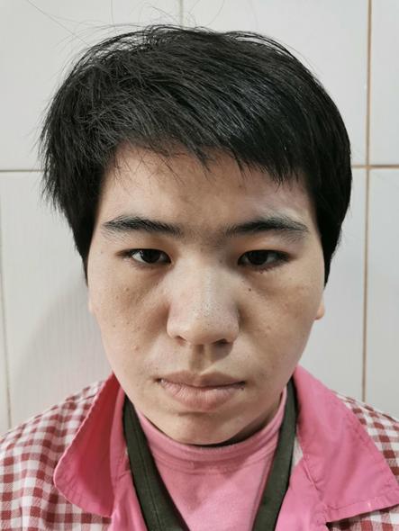 走失者照片 南京市寻亲：青年女子被救助，高1米...