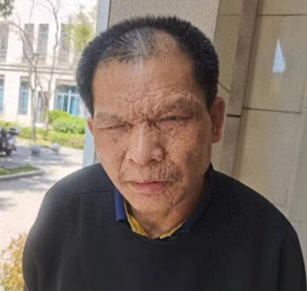 走失者照片 安庆市桐城市寻亲：中年男子被救助，...