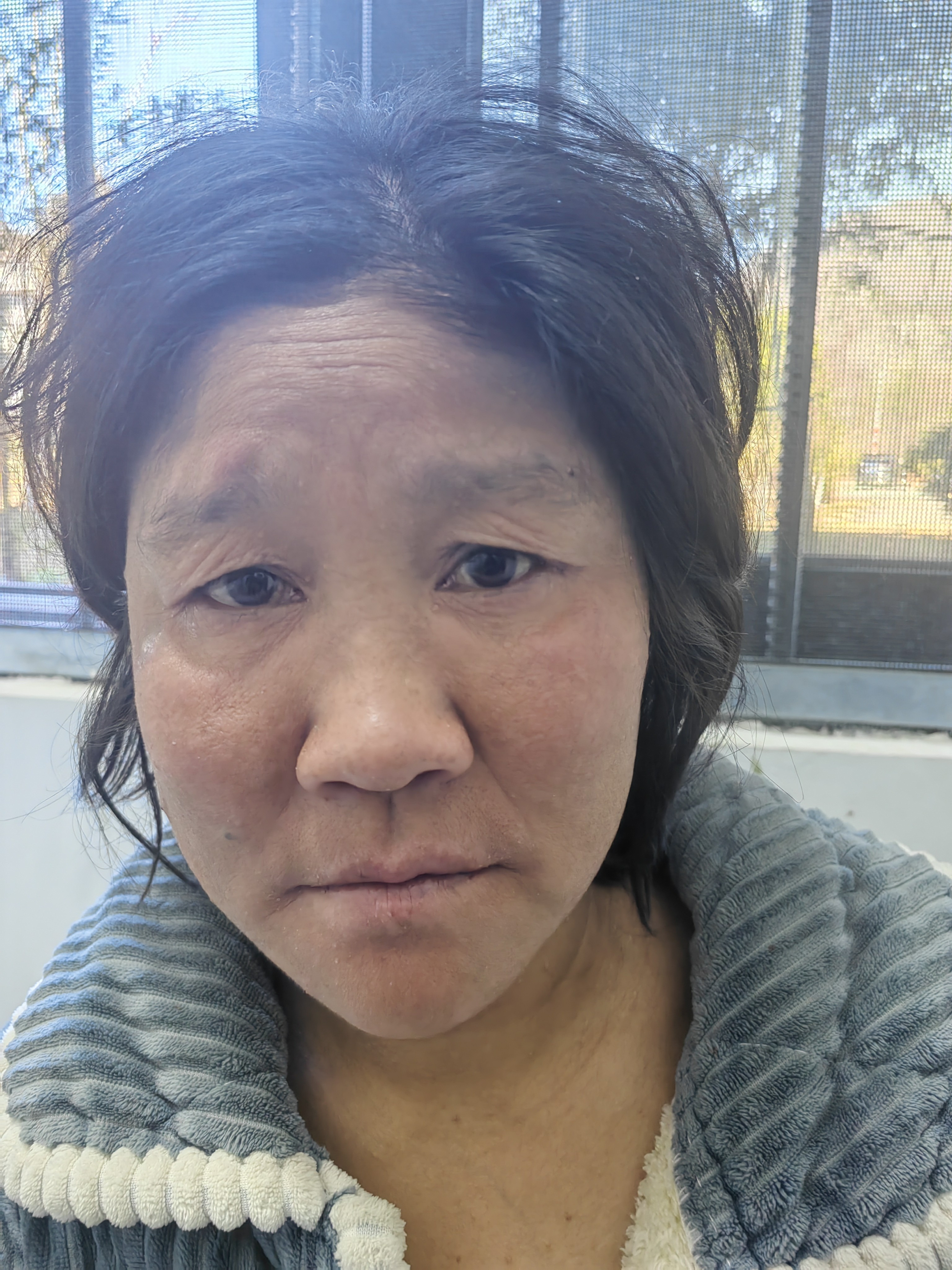 走失者照片 六盘水市盘州市寻亲：五旬女子被救助...