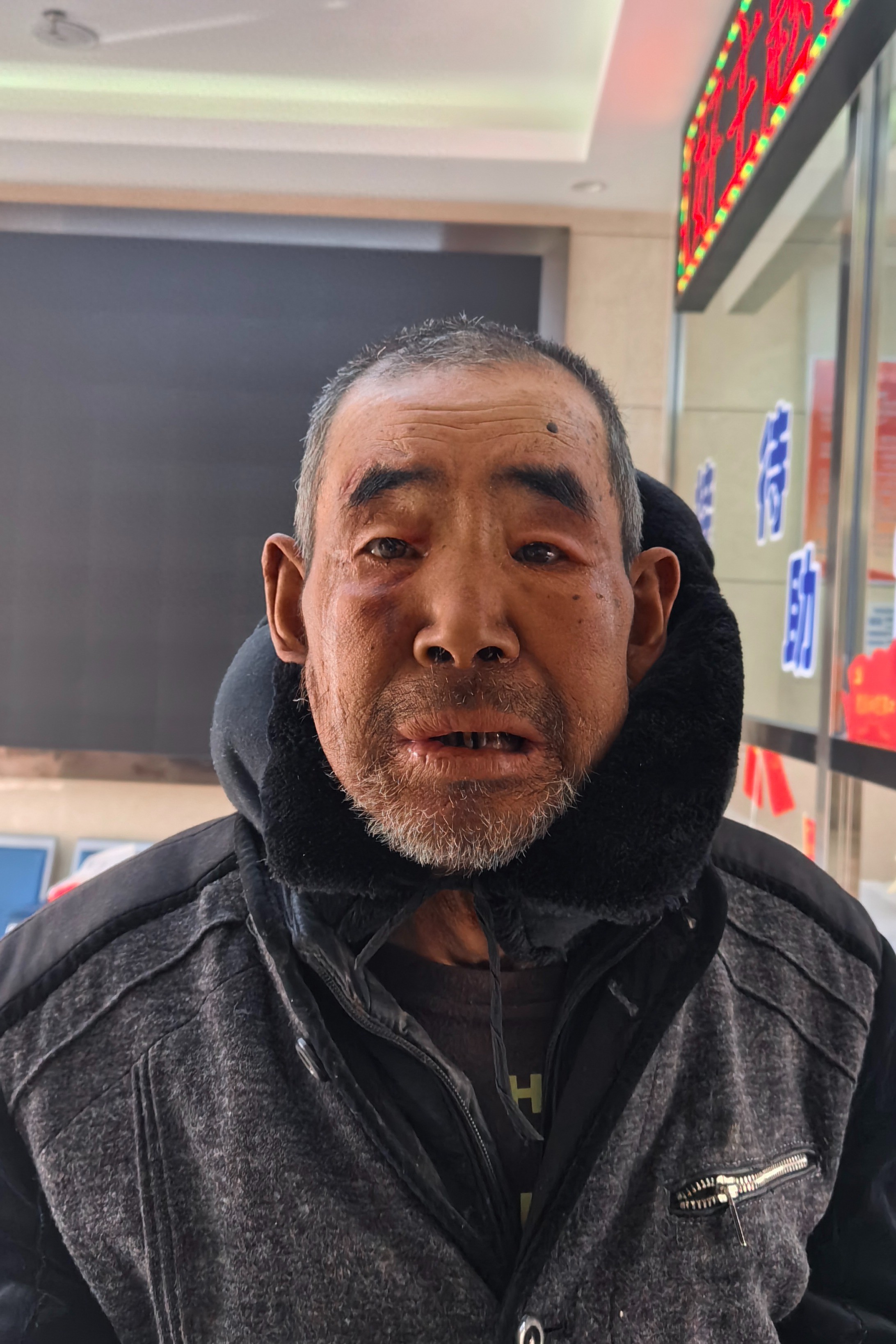 走失者照片 包头市寻亲：六旬老人被救助，自述叫...