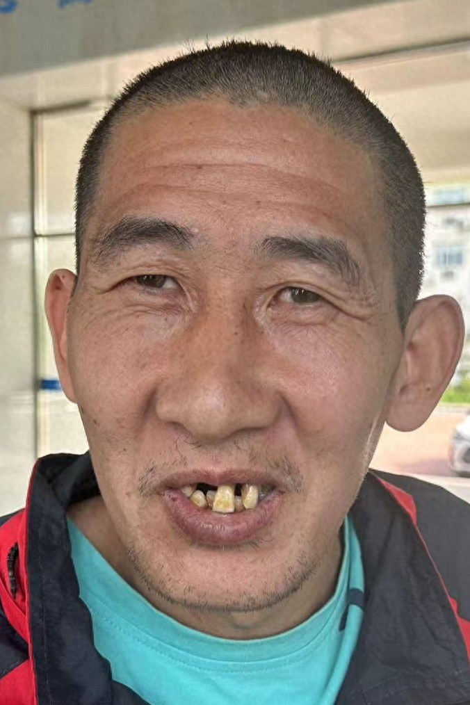 走失者照片 合肥市寻亲：中年男子被救助，高1米...