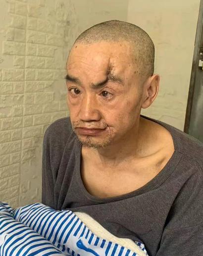 走失者照片 黔南州寻亲：六旬老人被救助，穿蓝黑...