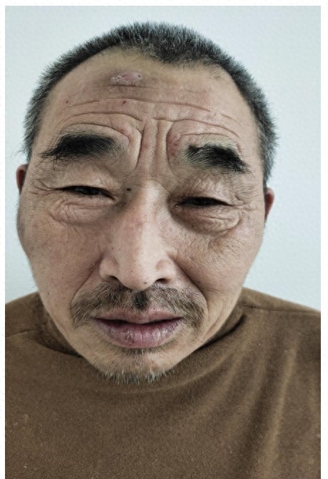 走失者照片 青岛市即墨市寻亲：七旬老人被救助，...