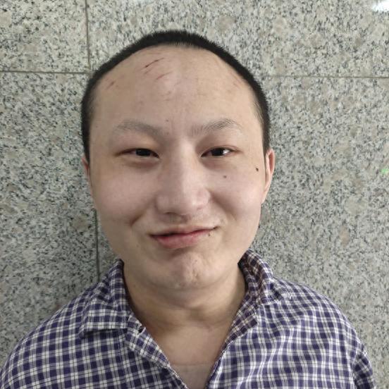走失者照片 南京市寻亲：15岁男孩被救助，高1...
