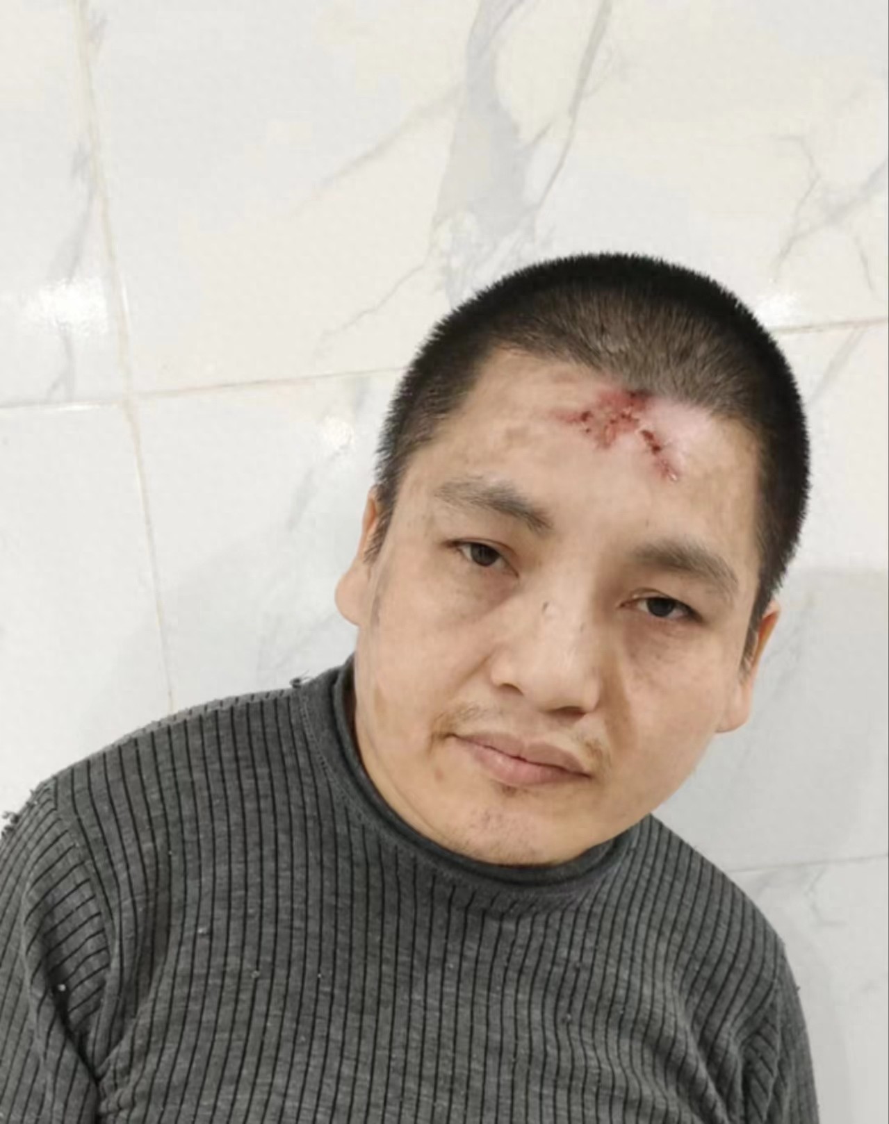 走失者照片 长沙市寻亲：青年男子被救助，疑似株...