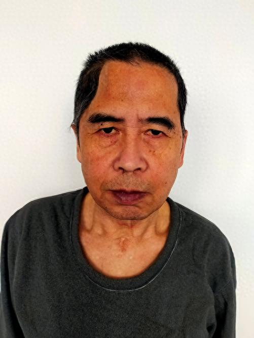 走失者照片 北京市寻亲：中年男子被救助，高1米...