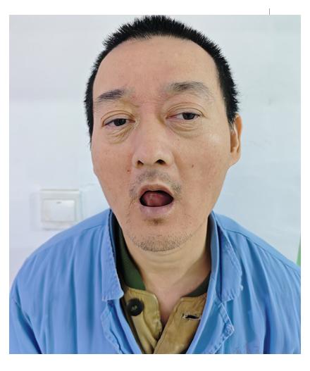 走失者照片 三明市寻亲：中年男子被救助，疑似河...