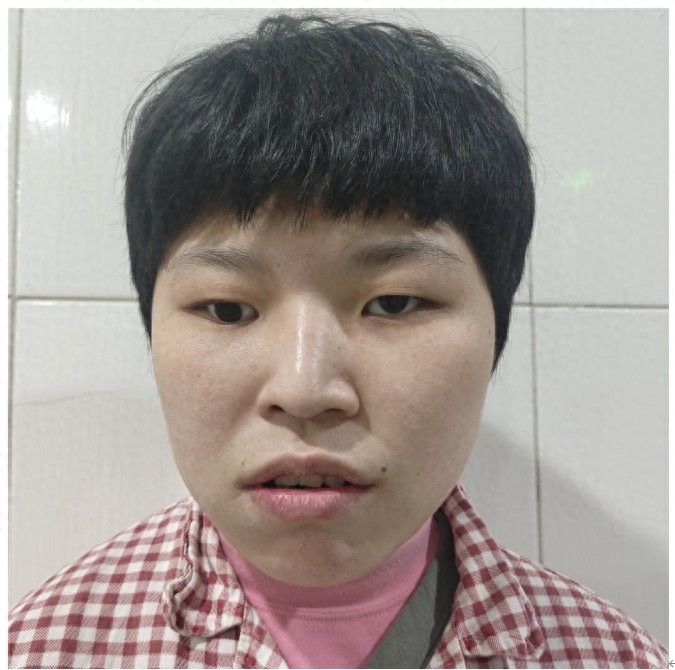 走失者照片 南京市寻亲：15岁女孩被救助，安徽...