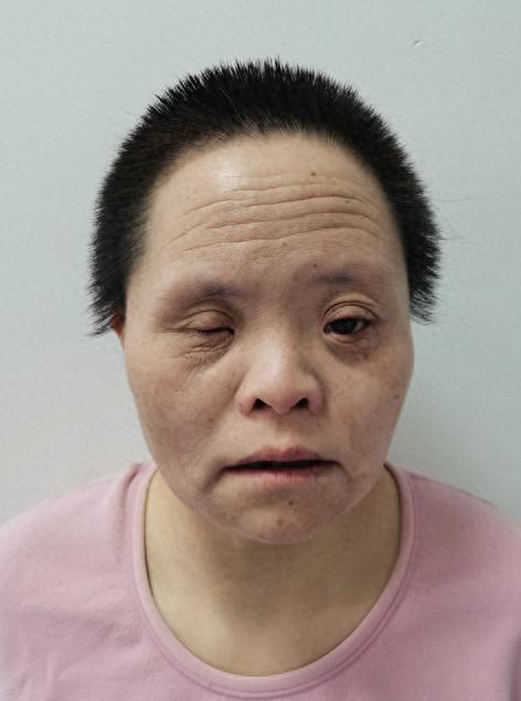 走失者照片 北京市寻亲：中年女子被救助，高1米...