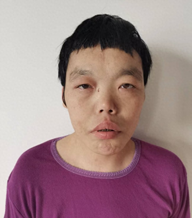 走失者照片 北京市寻亲：青年女子被救助，高1米...