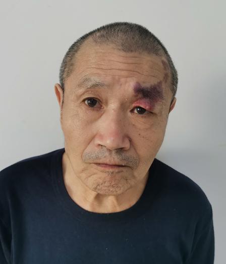 走失者照片 北京市寻亲：五旬男子被救助，高1米...