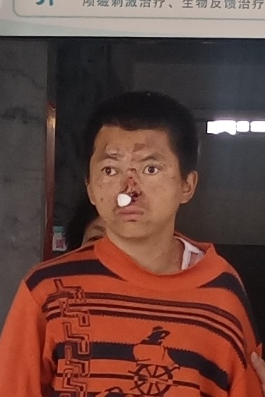 走失者照片 三明市寻亲：青年男子被救助，穿橙色...