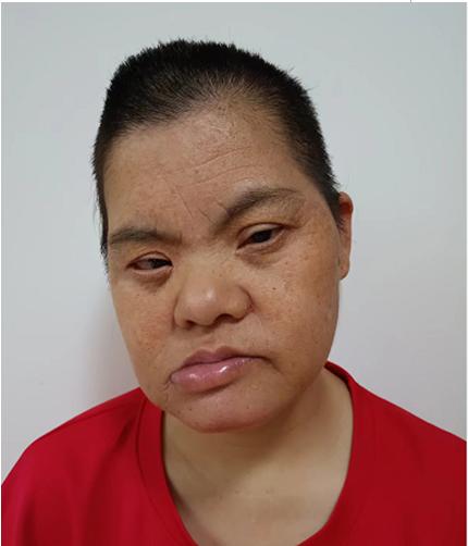 走失者照片 福州市寻亲：中年女子被救助，高1米...