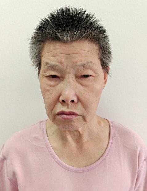 走失者照片 北京市寻亲：中年女子被救助，高1米...