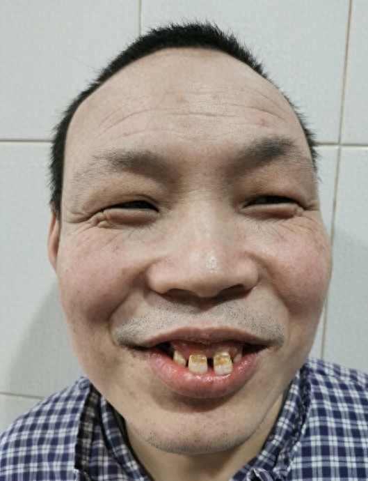 走失者照片 南京市寻亲：青年男子被救助，自述叫...