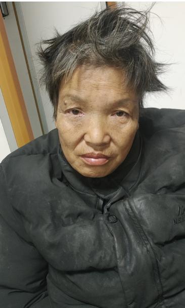 走失者照片 亳州市寻亲：五旬女子被救助，名叫陈...