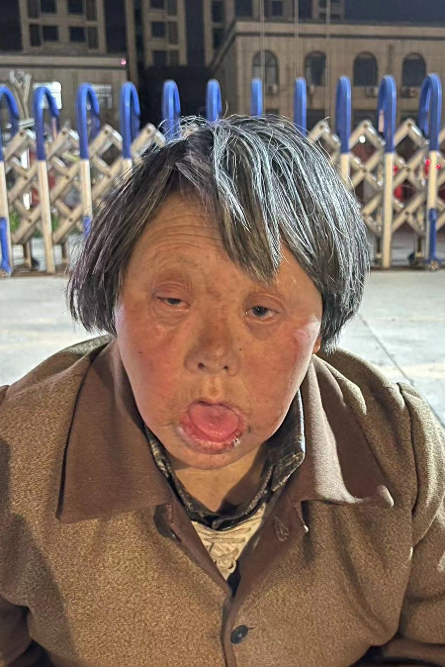 走失者照片 商丘市寻亲：五旬女子被救助，穿棕黄...