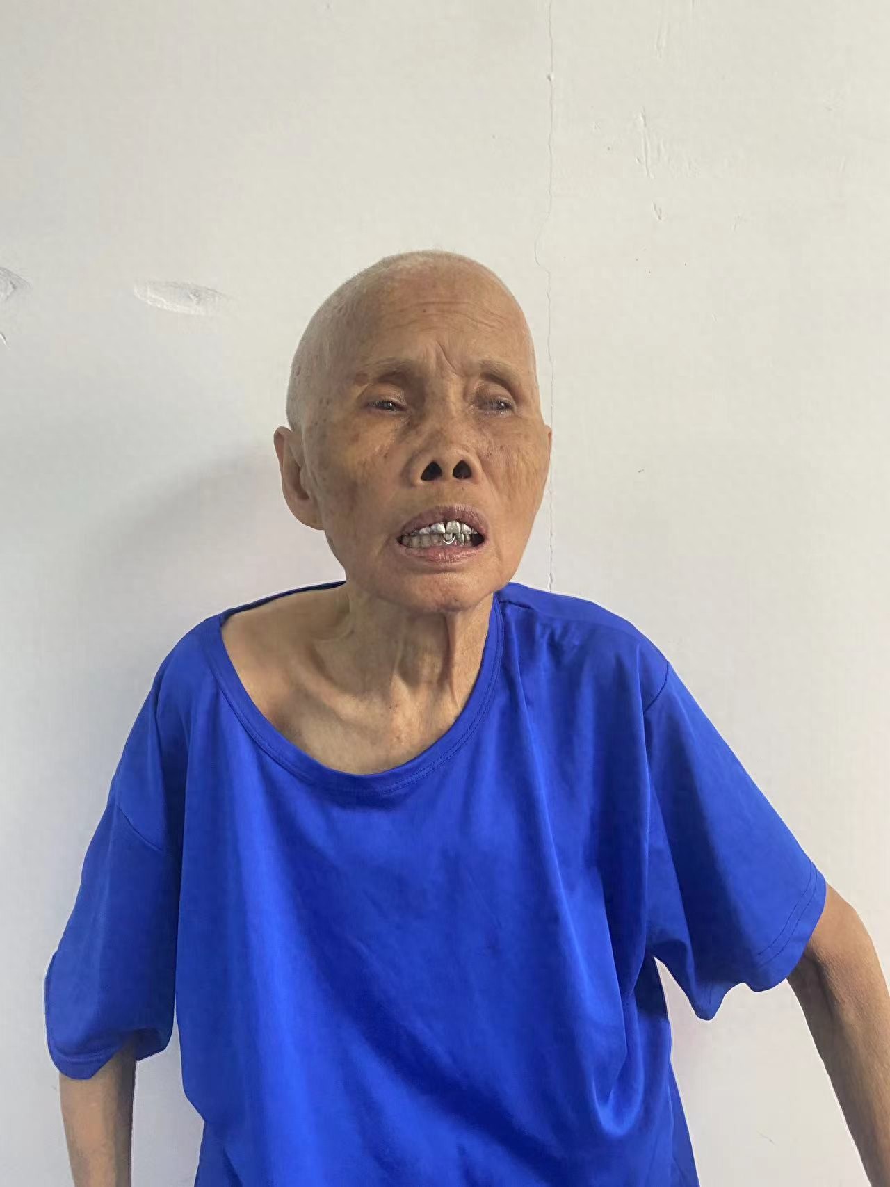 走失者照片 湛江市廉江市寻亲：七旬老太被救助，...