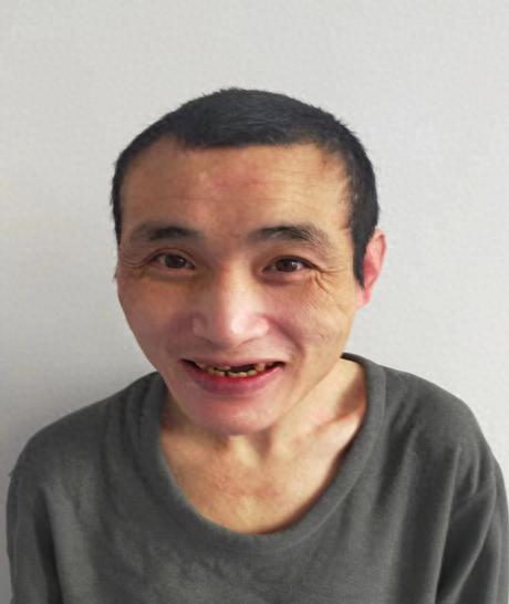 走失者照片 北京市寻亲：青年男子被救助，高1米...