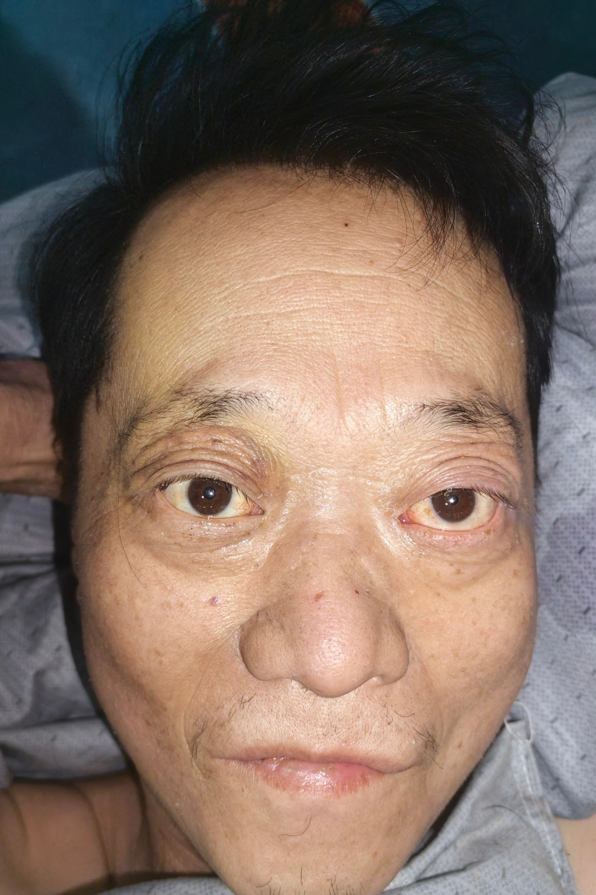走失者照片 包头市寻亲：六旬老人被救助，高1米...