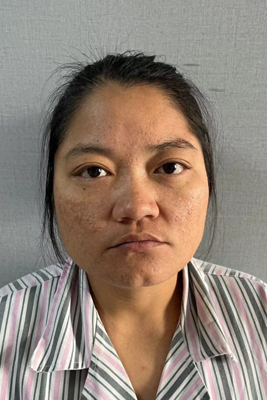 走失者照片 海口市寻亲：青年女子被救助，自述叫...