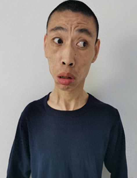 走失者照片 北京市寻亲：青年男子被救助，高1米...