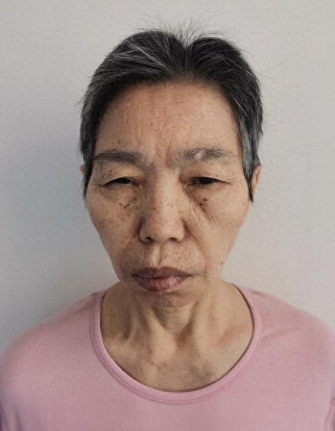 走失者照片 北京市寻亲：五旬女子被救助，高1米...
