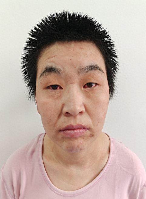 走失者照片 北京市寻亲：中年女子被救助，高1米...