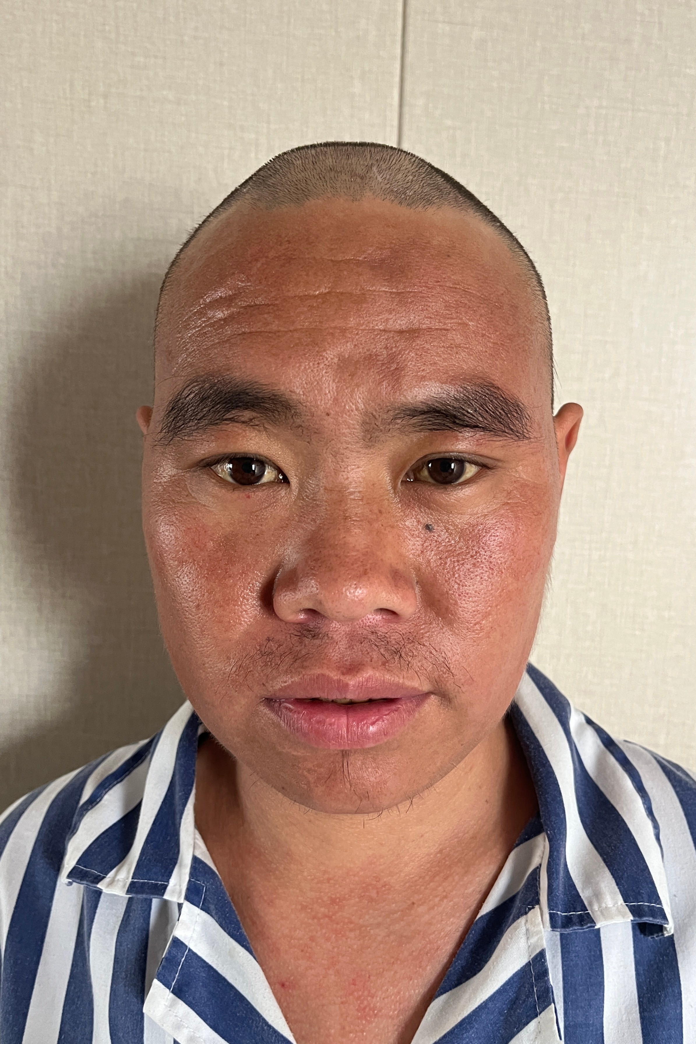 走失者照片 海口市寻亲：青年男子被救助，高1米...