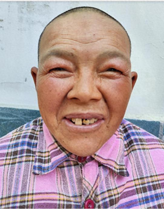 走失者照片 成都市寻亲：中年女子被救助，黑色短...