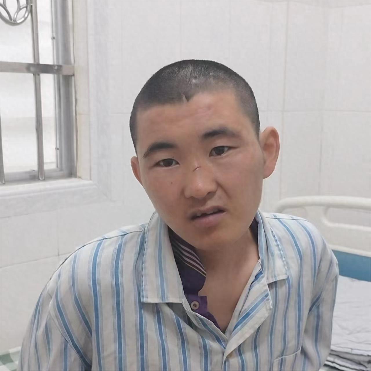 走失者照片 惠州市寻亲：18岁男孩被救助，穿卡...