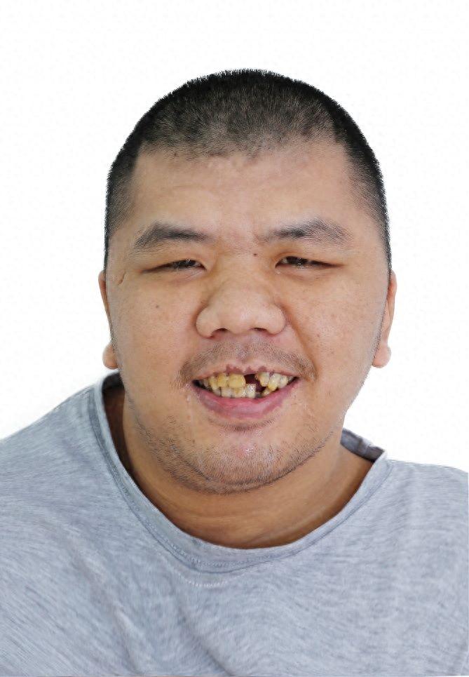 走失者照片 佛山市寻亲：青年男子被救助，疑似广...