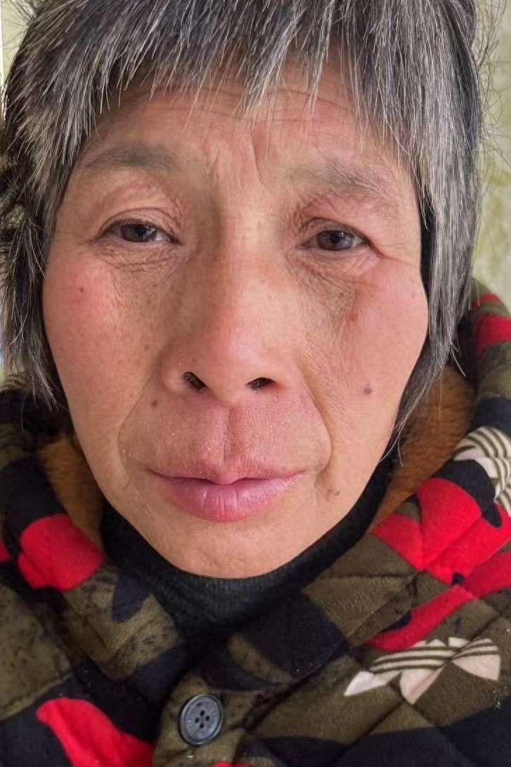 走失者照片 南阳市寻亲：五旬女子被救助，灰白短...