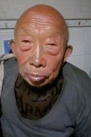 走失者照片 延安市寻人：八旬老人走失，穿黑色衣...
